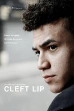 Film Cleft Lip (Cleft Lip) 2018 online ke shlédnutí